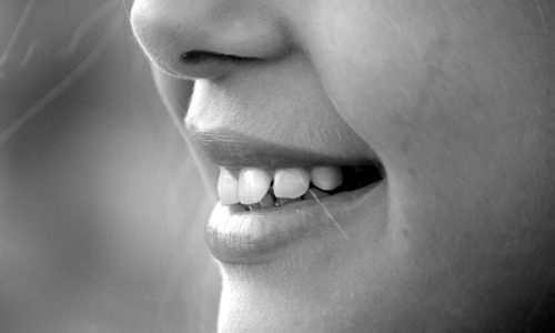 smile-mouth-teeth-laugh-65665 Linki sponsorowane Google AdWords – co to jest? - zdjęcie nr 12
